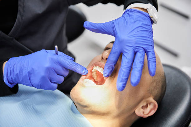 Best Emergency Treatment for Dental Infections or Abscesses in Hollis, OK
